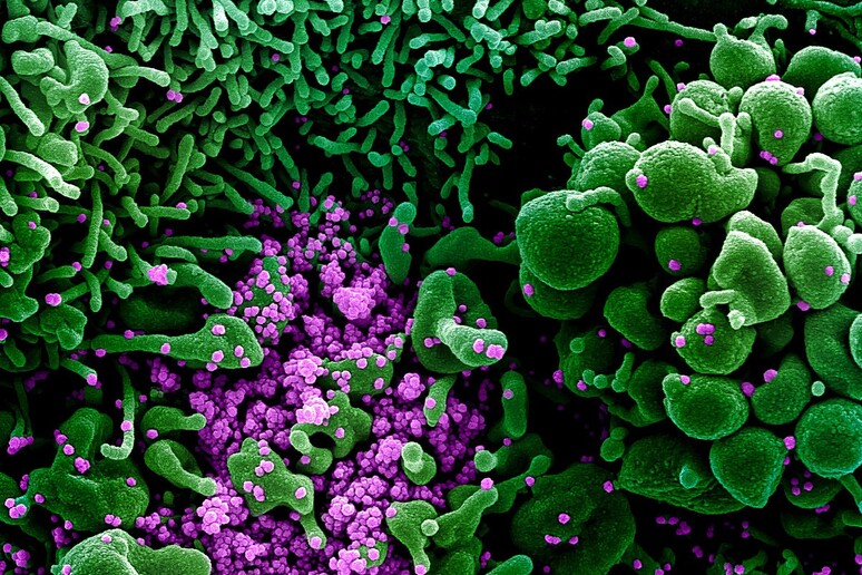 Particelle del virus SarsCoV2 (in violetto) sulla superficie di una cellula (fonte: NIAID) - RIPRODUZIONE RISERVATA