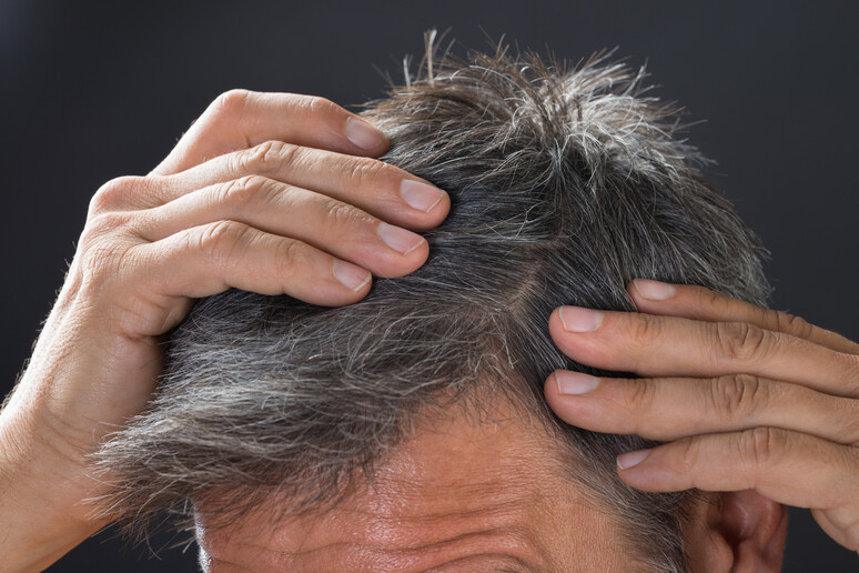 Covid: 30% pazienti perde capelli in grande quantità - RIPRODUZIONE RISERVATA