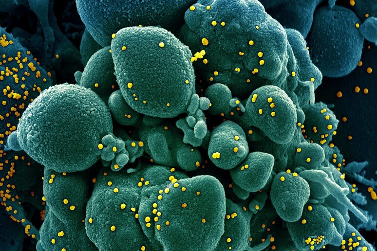 In giallo particelle del virus SarsCoV2 su una cellula (fonte: NIAID) - RIPRODUZIONE RISERVATA
