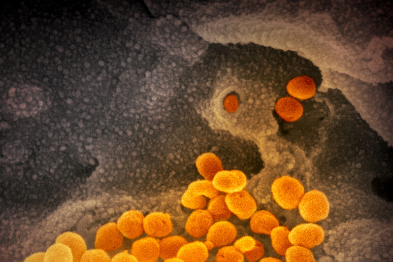 Una delle immagini del coronavirus SarsCov2 ottenute dal Niaid con il microscopio elettronico. le particelle virali sono colorate in arancio (fonte: NIAID-RML) - RIPRODUZIONE RISERVATA