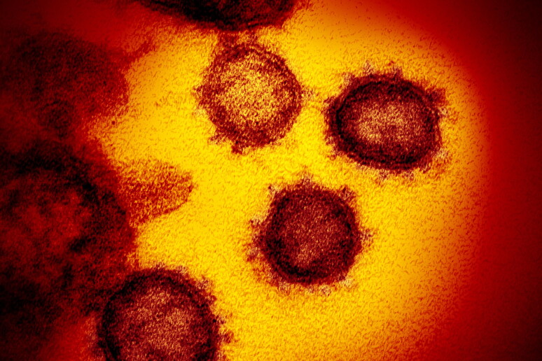 Un 'immagine del coronavirus al microscopio elettronico. NIH © ANSA/EPA