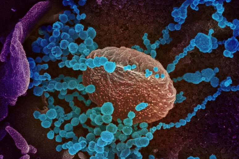 Un 'immagine del SARS-Cov2 al microscopio elettronico, National Institutes of Health © ANSA/EPA