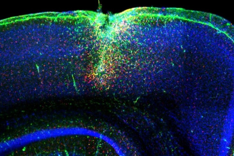I neuroni attivati dalla luce grazie alla molecola nata in laboratorio (fonte: IIT) - RIPRODUZIONE RISERVATA