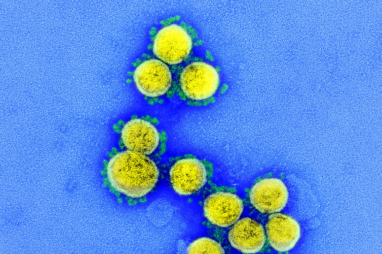 Particelle virali di SarsCoV2 (fonte: NIAID) - RIPRODUZIONE RISERVATA
