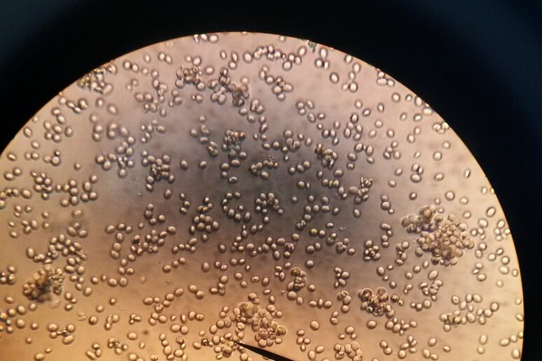 Cellule di lievito viste al miscroscopio (fonte: Sam LaRussa, Flickr) - RIPRODUZIONE RISERVATA