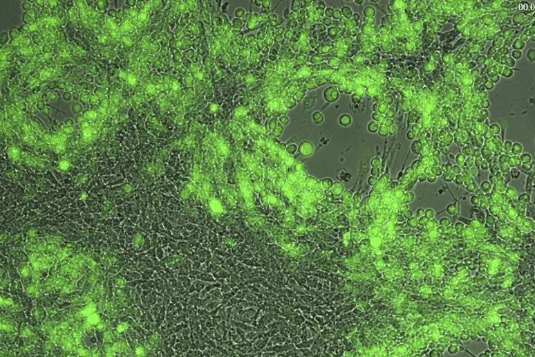 In verde le cellule in cui il virus oncolitico si sta replicando (fonte: Ceinge) - RIPRODUZIONE RISERVATA