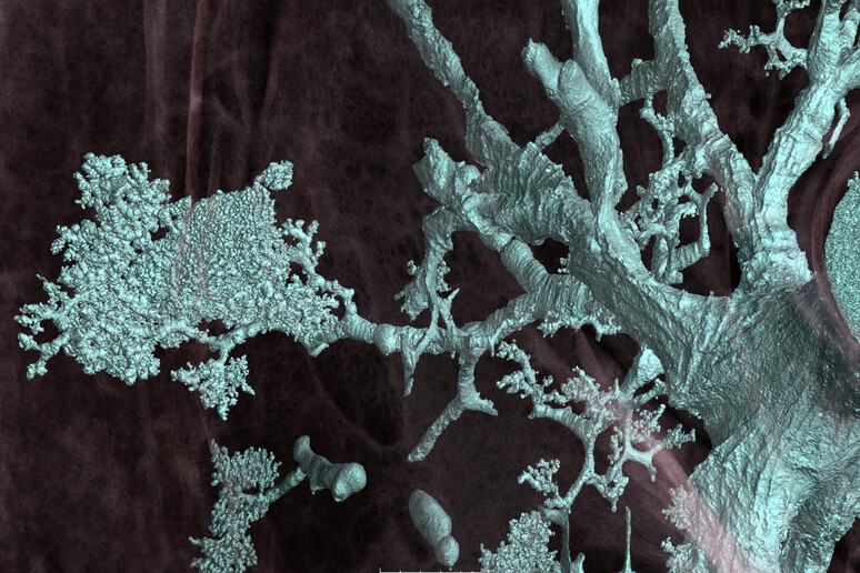 Particolare di un polmone colpito dal virus SarsCoV2, visto grazie al sinctrotone di Grenoble (fonte: ESRF) - RIPRODUZIONE RISERVATA