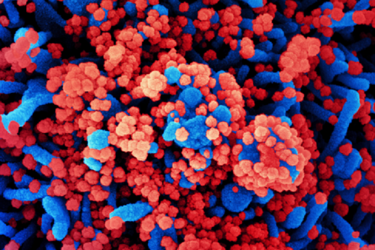 In rosso le particelle del virus SarsCoV2 sulla superficie di una cellula (fonte: NIAID Integrated Research Facility in Fort Detrick, Maryland) - RIPRODUZIONE RISERVATA