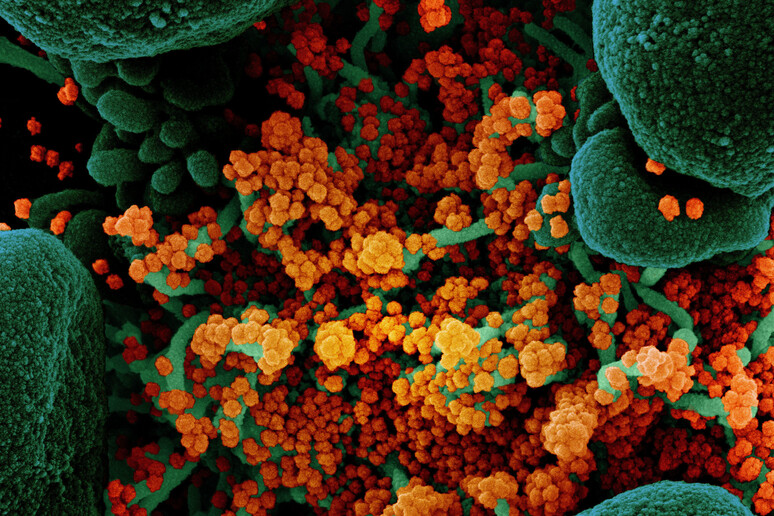 In arancione le particelle del virus SarsCoV2 (fonte: NIAID) - RIPRODUZIONE RISERVATA