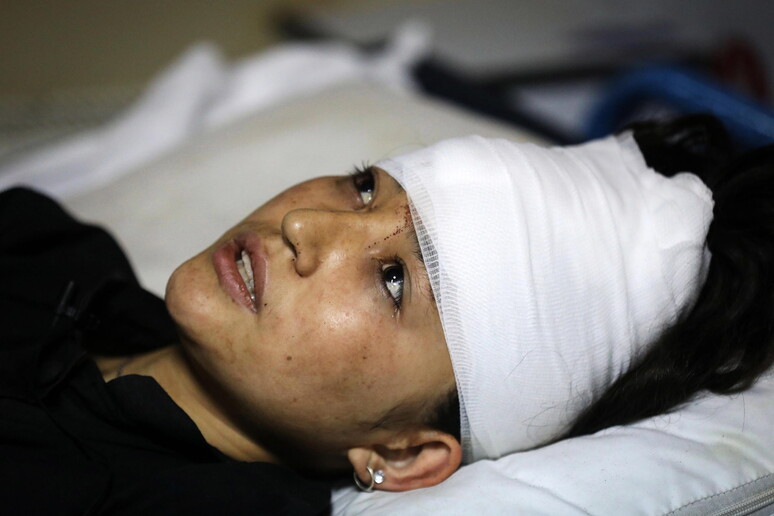 Una studentessa rimasta ferita © ANSA/EPA