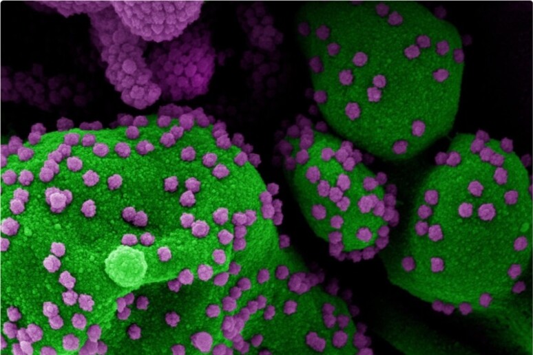 Particelle del virus SarsCoV2 su una cellula (fonte: NIAID) - RIPRODUZIONE RISERVATA