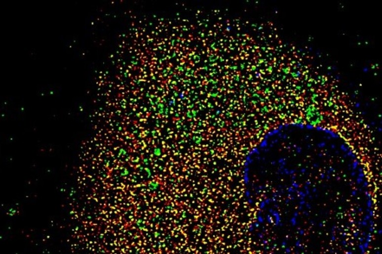 Cellula umana epiteliale nasale infettata con la variante Alfa del virus SarsCoV2 per 72 ore (fonte: CEINGE-Biotecnologie avanzate) - RIPRODUZIONE RISERVATA