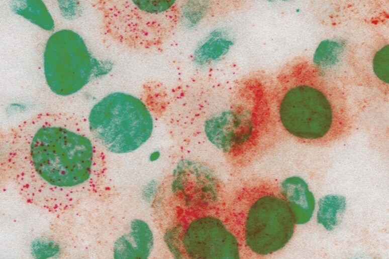 In rosso la proteina Spike con cui il virus attacca le cellule dell’epitelio bronchiale (fonte: Humanitas) - RIPRODUZIONE RISERVATA