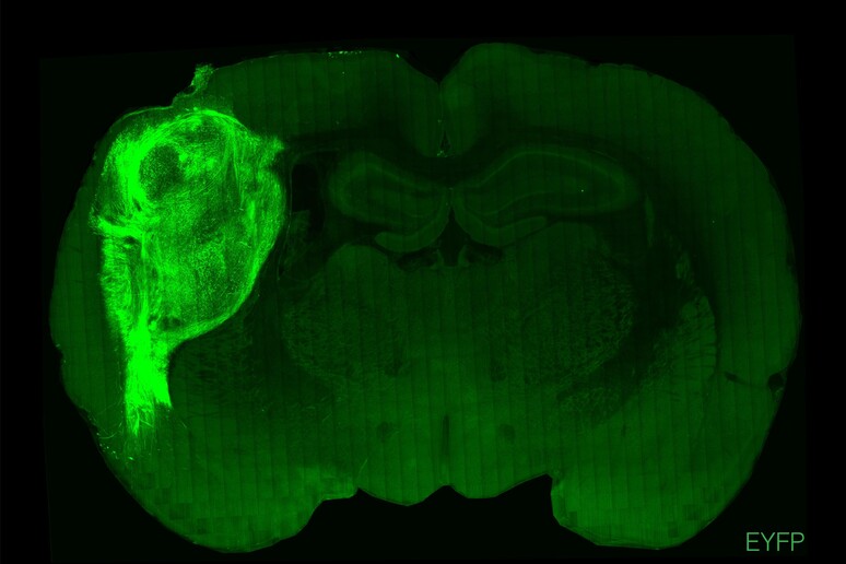L 'organoide umano impiantato nel cervello di ratto, contrassegnato con una proteina fluorescente per renderlo visibile (fonte: Stanford University) - RIPRODUZIONE RISERVATA