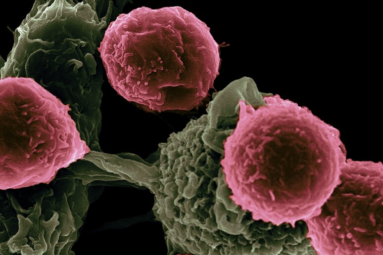 Quando le cellule T combattono un tumore troppo a lungo, finiscono per stancarsi e passare al nemico (fonte: Unsplash) - RIPRODUZIONE RISERVATA