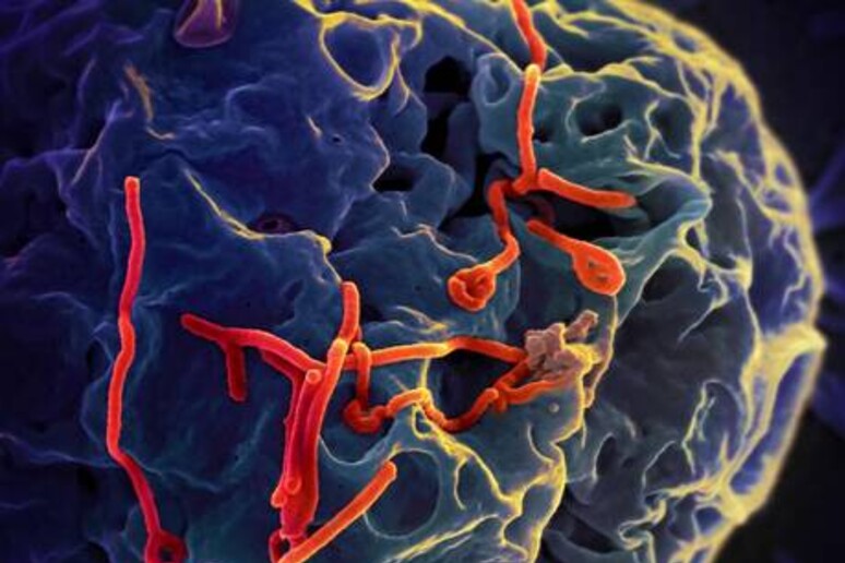 Una cellula attaccata dal virus Ebola (fonte: NIAID-NIH) - RIPRODUZIONE RISERVATA