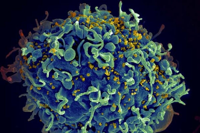 Una cellula umana attaccata dal virus Hiv (fonte: S. Pincus, E. Fischer, A. Athman, NIAID/NIH) - RIPRODUZIONE RISERVATA