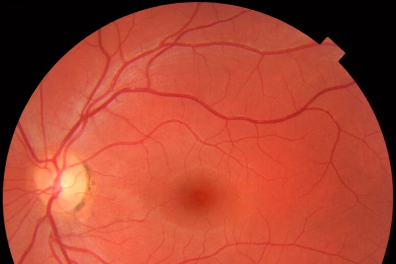 Cellule della retina sono state riattivate dopo la morte (fonte: M. Haggstrom, Wikimedia) - RIPRODUZIONE RISERVATA