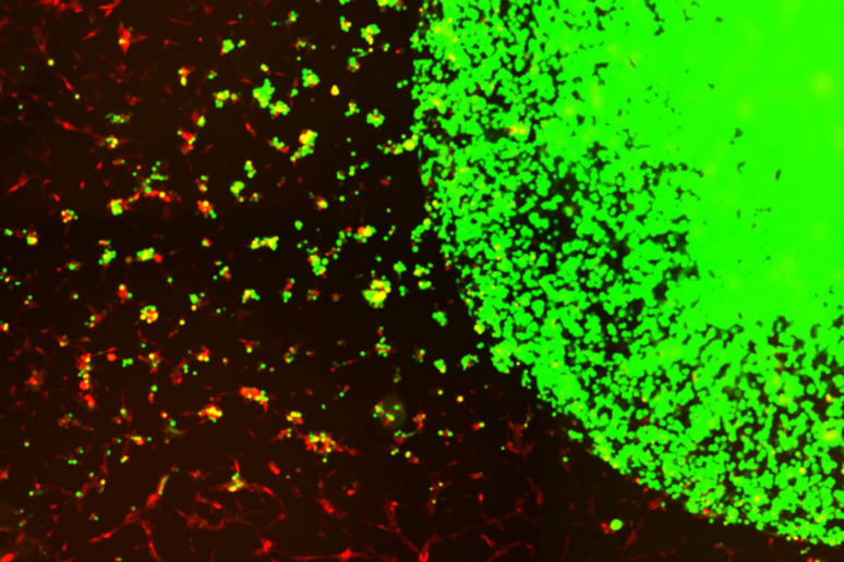 Le cellule staminali modificate (in verde) intercettano e uccidono le cellule tumorali (in rosso) (Fonte: Shah lab (CSTI)) - RIPRODUZIONE RISERVATA