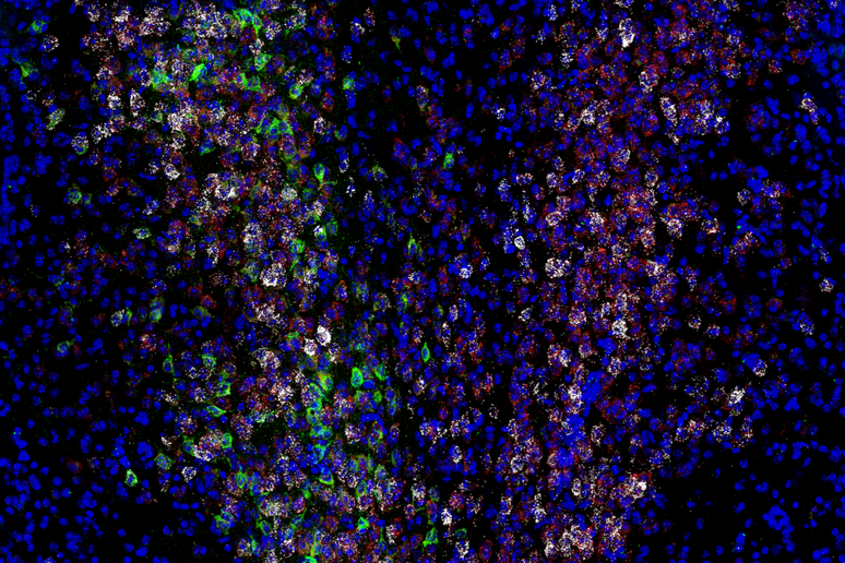 L 'immagine mostra l 'espressione di vari geni e proteine (i colori bianco, rosso e verde) all 'interno dei neuroni di topo (in blu) (Fonte: Salk Institute) - RIPRODUZIONE RISERVATA