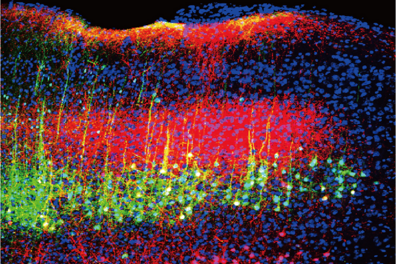 Il suono riduce il dolore nei topi diminuendo l 'attività dei neuroni nella corteccia uditiva del cervello (verde e magenta) (fonte: Wenjie Zhou) - RIPRODUZIONE RISERVATA