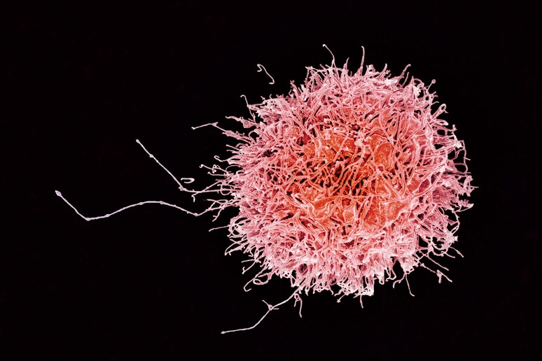 Una cellula del sistema immunitario umano (fonte: National Institutes of Allergy and Infectious Diseases, National Institutes of Health, da Flickr) -     RIPRODUZIONE RISERVATA