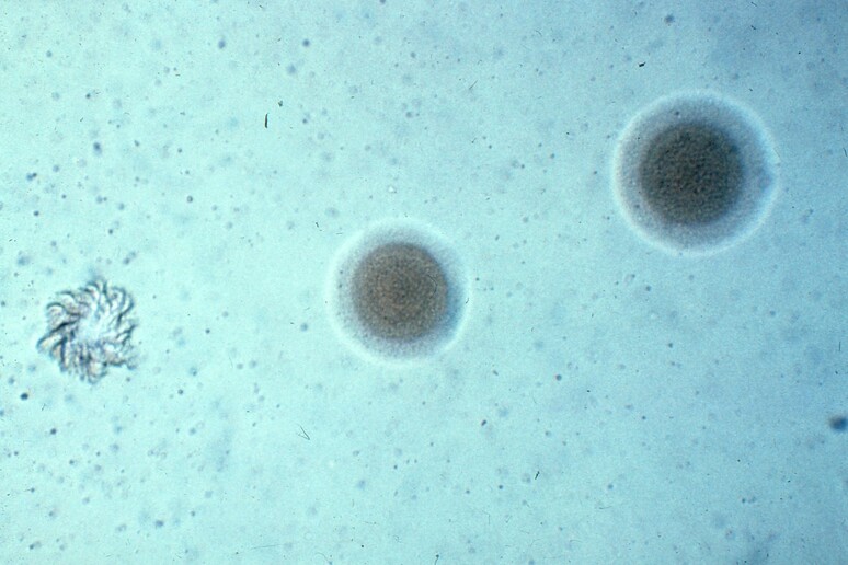 Il mycoplasma pnaumoniae è uno degli indiziati per i focolai di polmoniti in Cina (fonte: NIAID, CC BY-NC-SA 2.0) - RIPRODUZIONE RISERVATA