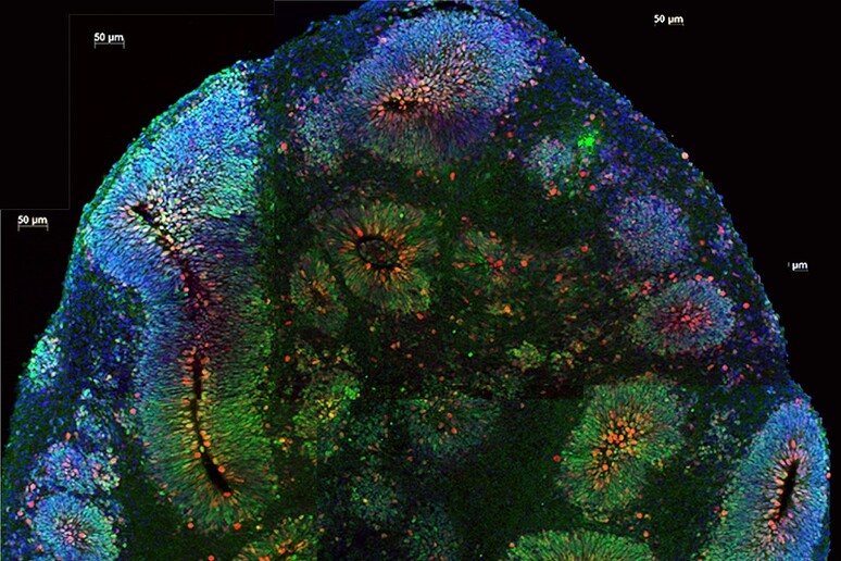 Brain organoids (Credit: Vaccarino Lab, Yale University, Science) - RIPRODUZIONE RISERVATA