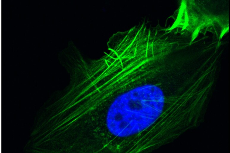 In azzurro il nucleo di una cellula ricco della proteina Grp78 (fonte: Ze Liu, PhD, Amy Lee, PhD) - RIPRODUZIONE RISERVATA