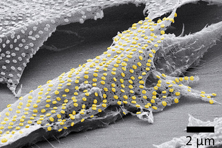 Il tatuaggio in oro su un fibroblasto vivente  (fonte:  Nano Letters, 2023, DOI: 10.1021/acs.nanolet - RIPRODUZIONE RISERVATA