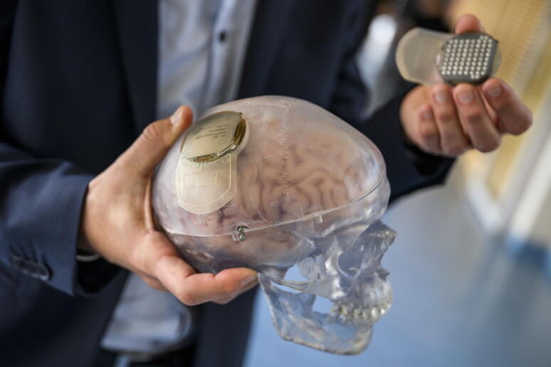 Musk, effettuato primo impianto Neuralink su essere umano © ANSA/EPA