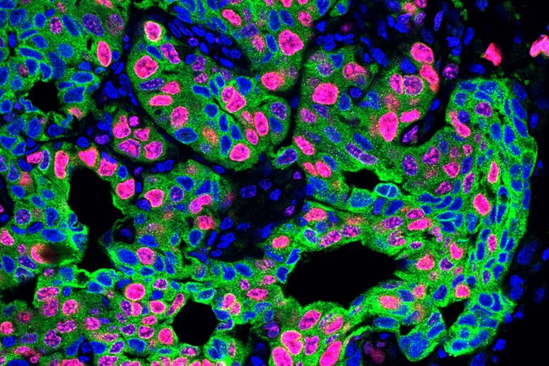 Le metastasi aumentano fino a quattro volte nei topi sottoposti a stress cronico (fonte: Egeblad lab/Cold Spring Harbor Laboratory) -     RIPRODUZIONE RISERVATA