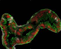 Staminali: intestino primo organo umano nato in provetta