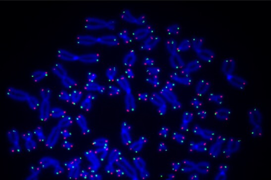 Parp1 gioca un ruolo fondamentale anche nella riparazione delle estremità dei cromosomi (fonte: O'Sullivan Lab)
